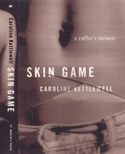 Skin Game: A Cutter’s Memoir