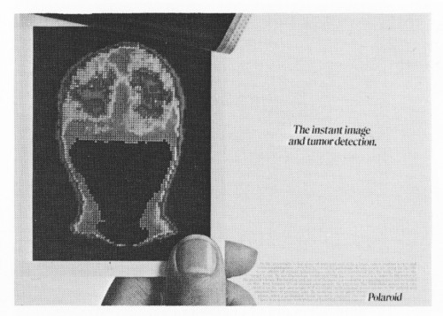"The instant image and tumor detection."