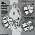 The Spine and What Can Go Wrong