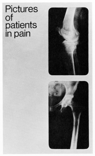 Pictures of Patients in Pain folder